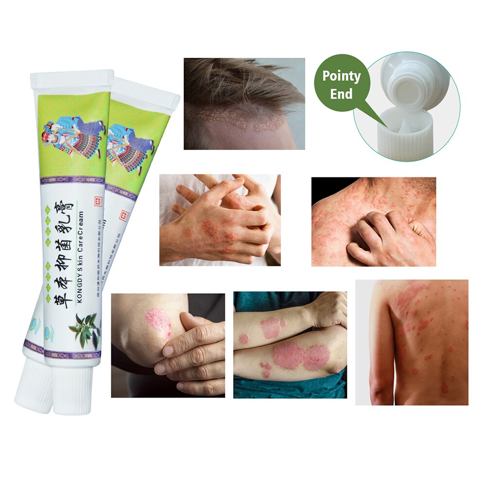 Ointment Massage Psoriasi Eczema Cream