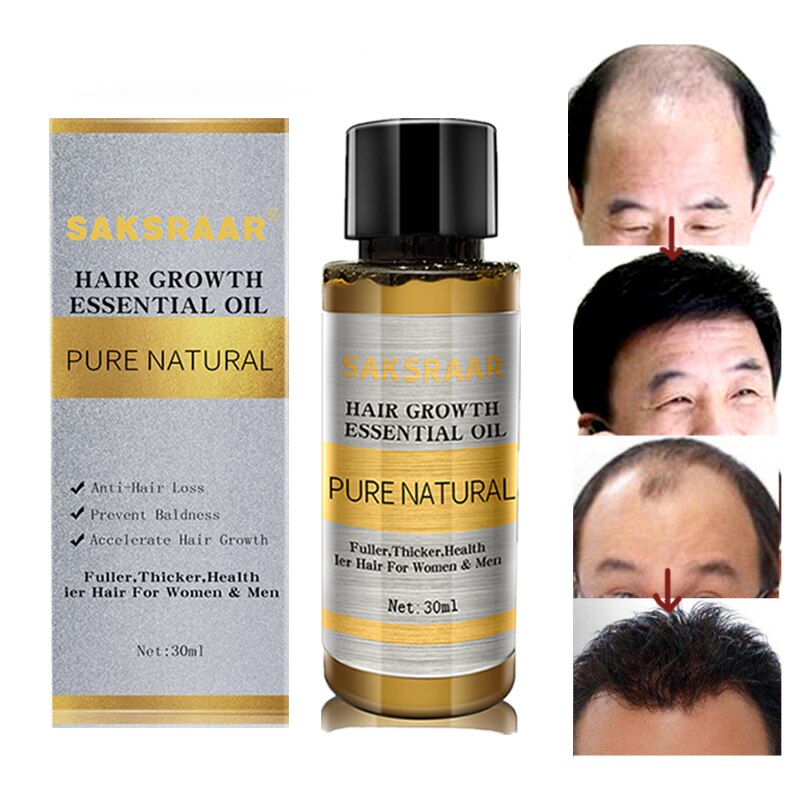 Hair Growth Essential Oils